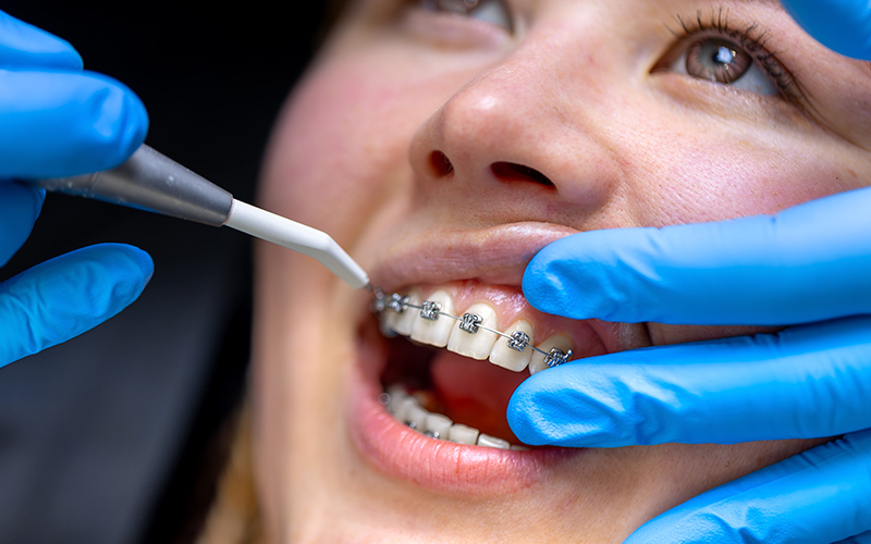 orthodontic